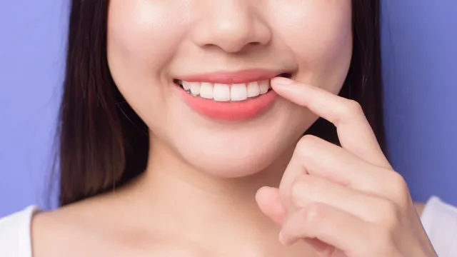 dental services in west haven