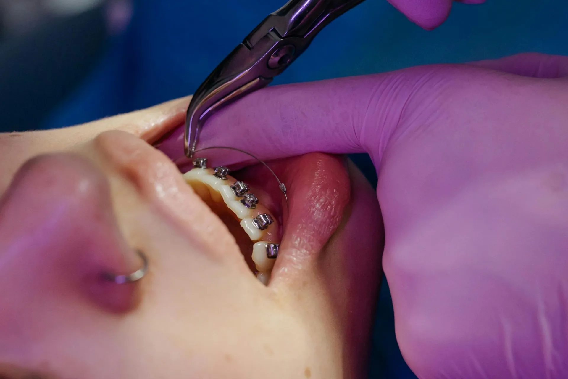 common dental myths in west haven