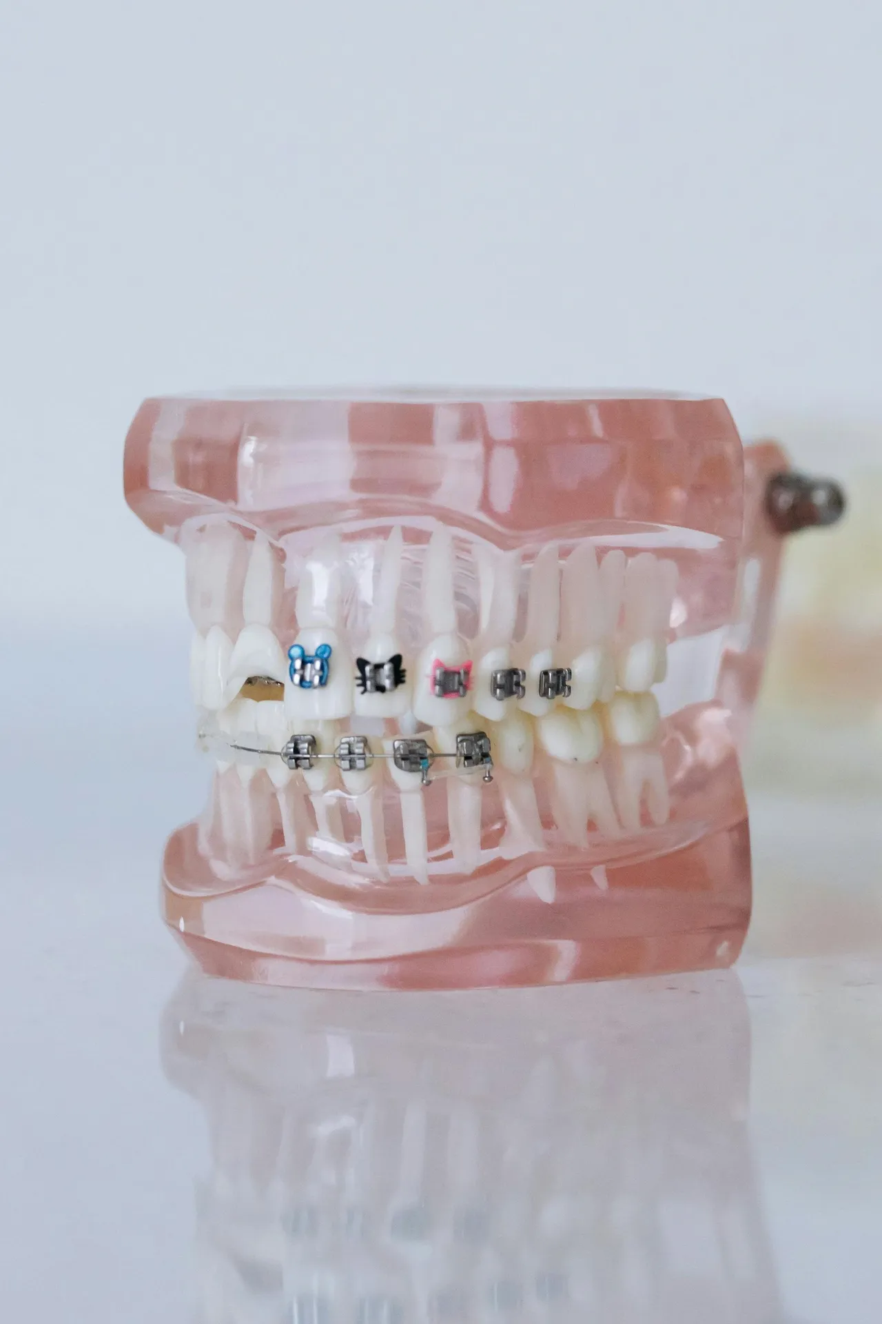 orthodontics in west haven