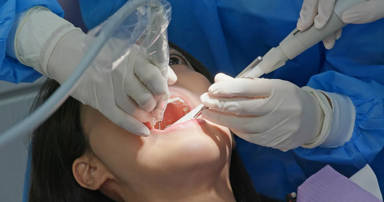 root canal treatment in West Haven, UT