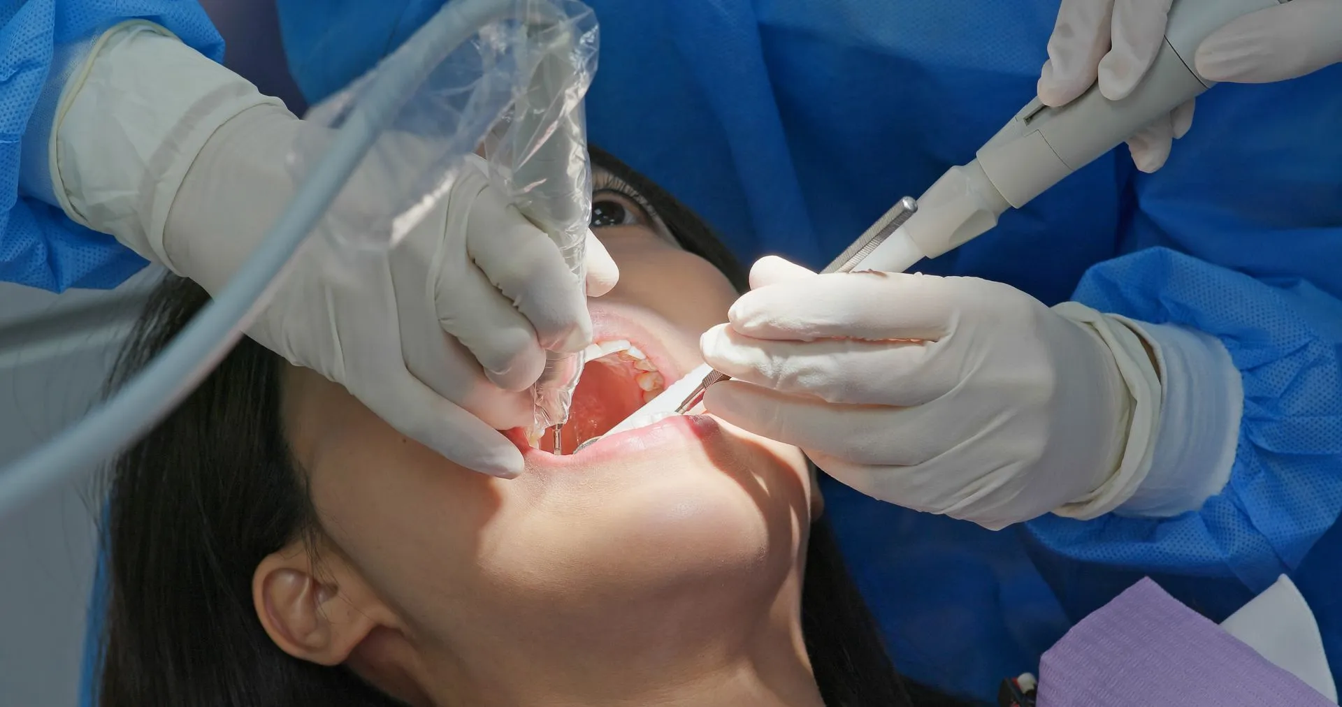 root canal treatment in West Haven, UT