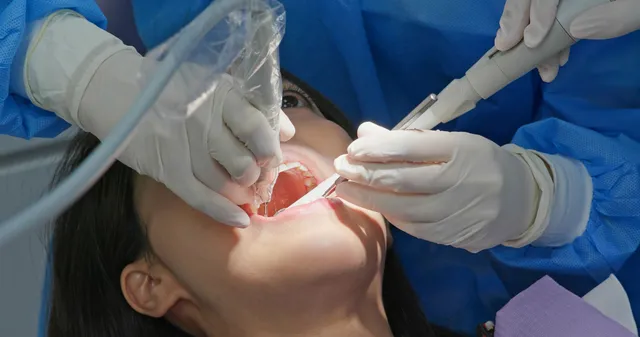 root canal treatment in West Haven, UT