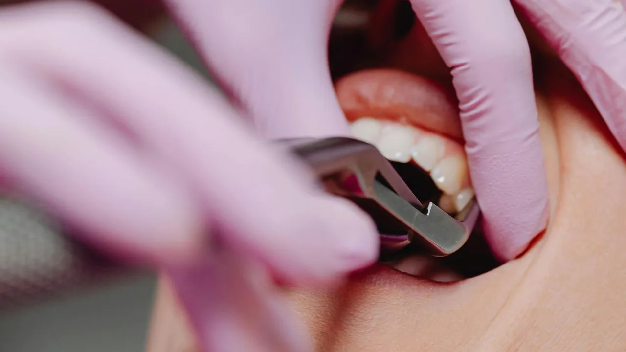 root canal in west haven
